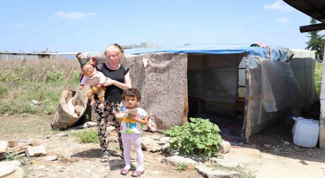 ‘Albino kadının Adana sıcağında yaşam mücadelesi